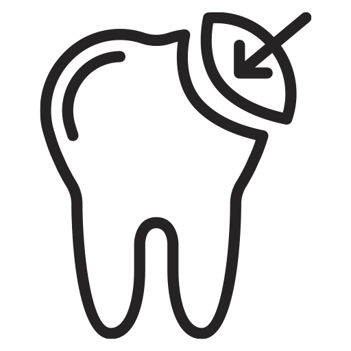 Composite Bonding
